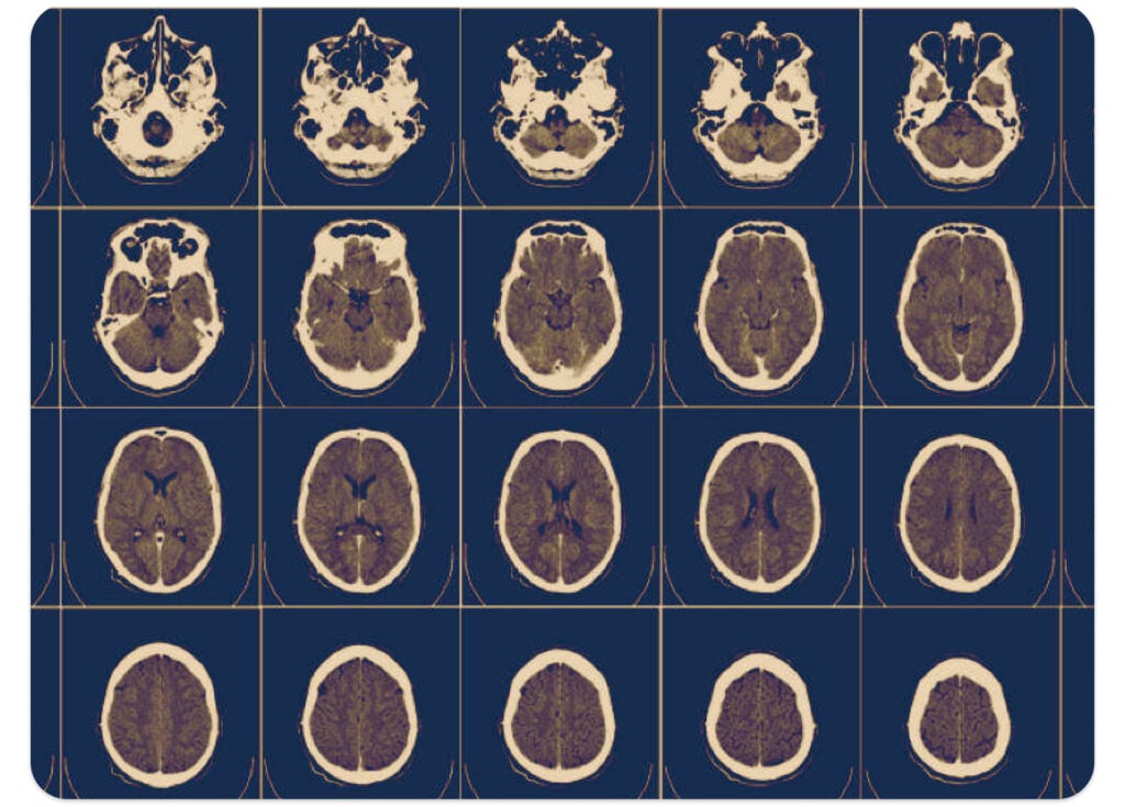 Pre-process large images, establish workflows, and identify suspicious areas with Ximilar visual AI.