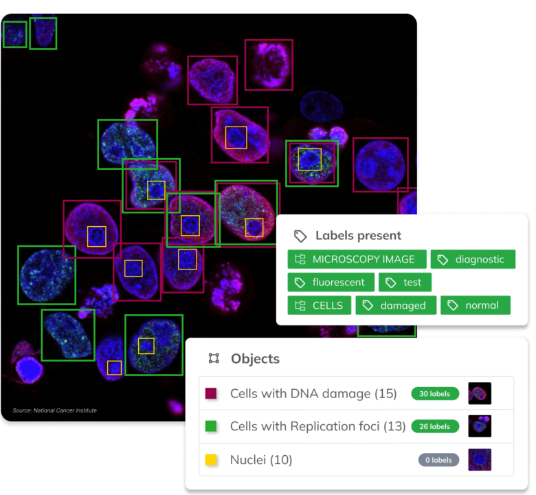 Visual AI by Ximilar can be customized with specific categories, objects, attributes, labels, whole taxonomies or even languages to fit specific use cases. In this case, object detection and image recognition are combined to spot and identify objects in a fluorescent microscopy image.